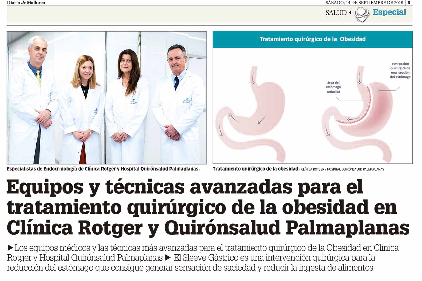 Tratamiento quirúrgico de la obesidad en Clínica Rotger