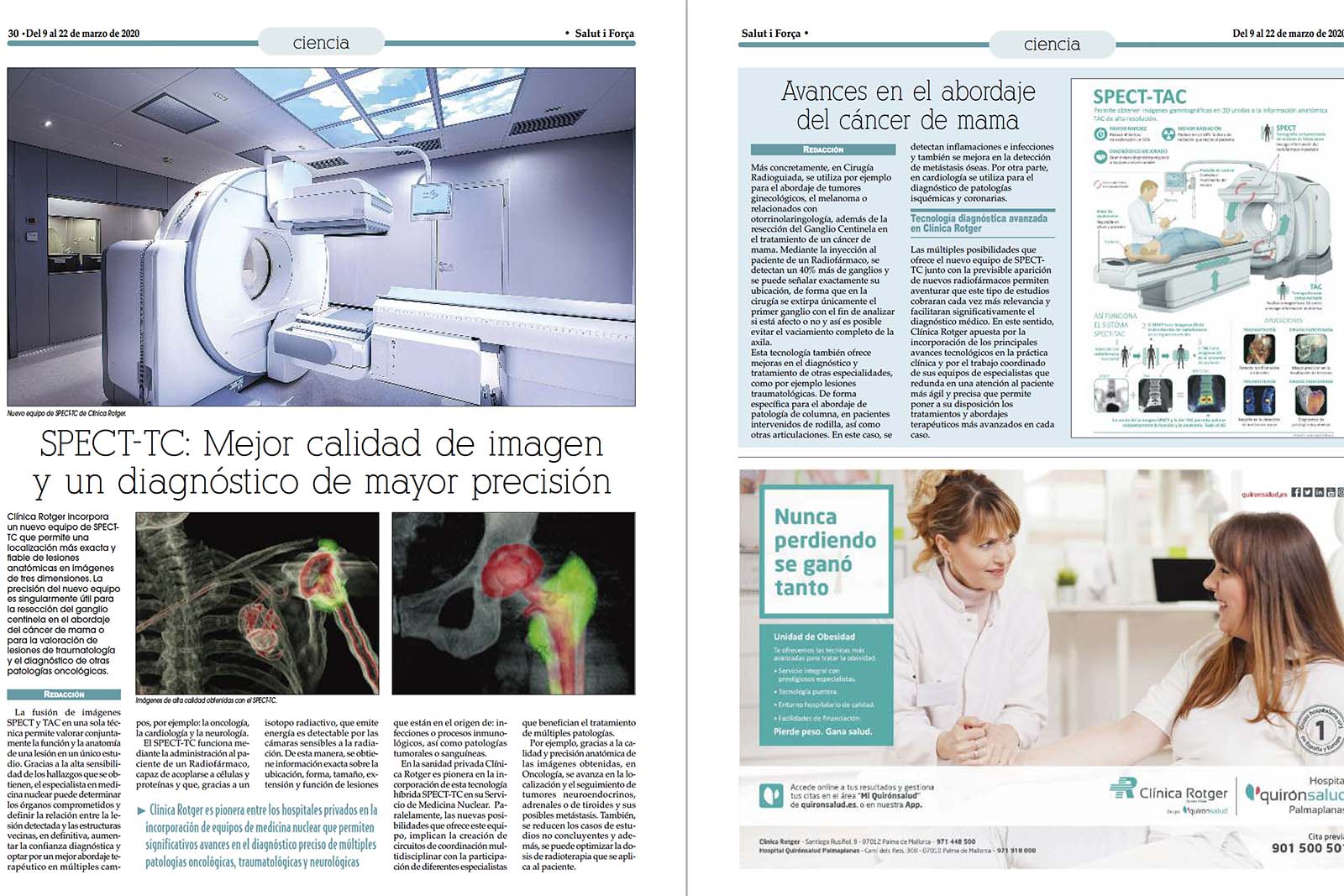 SPECT-TC-Clínica-Rotger-Hospital-Mallorca-Salut-i-Forca