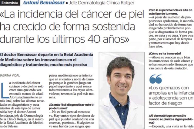 Entrevista-Ultima-Hora-Dr-Antoni Bennásar-Cáncer-de-Piel-Clínica-Rotger