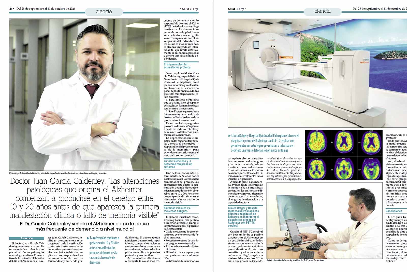 Las alteraciones patológicas que origina el Alzheimer
