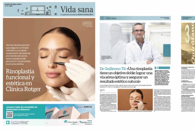 Rinoplastia-funcional-y-estetica-Clinica-Rotger