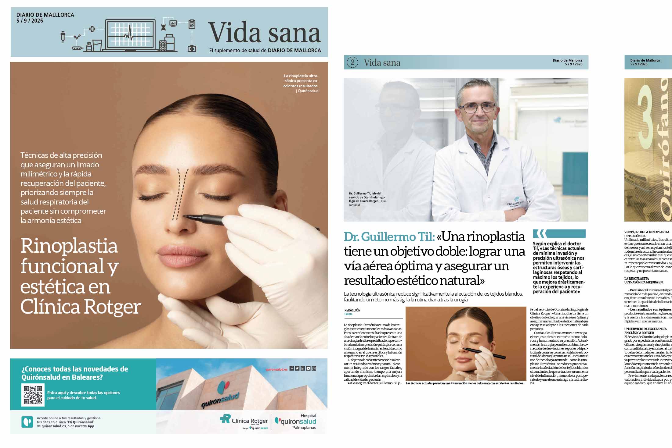Rinoplastia-funcional-y-estetica-Clinica-Rotger